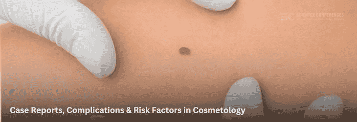 Case Reports, Complications & Risk Factors in Cosmetology